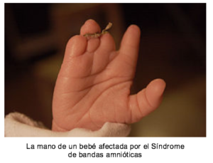 Captura de pantalla 2016-08-31 a las 11.21.08 a.m.