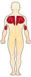 La palabra facio-escápulo-humeral se refiere a los músculos que mueven la cara, la escápula y el húmero (hueso superior del brazo).