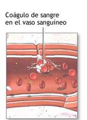 Las plaquetas o trombocitos: son pequeñas células de la sangre que ayudan a la sangre a coagularse y se adhieren a los vasos sanguíneos que se hayan dañado (por heridas o por traumatismos), para detener el sangrado.