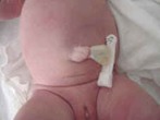 ¿Qué es el cordón umbilical?