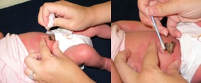 ¿Qué cuidados debo tener con el cordón umbilical de mi bebé?
