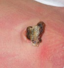 ¿Qué cuidados debo tener con el cordón umbilical de mi bebé?