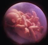 Embarazo múltiple: gemelos, triates, etc.