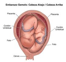 ¿Qué puedo esperar durante la labor de parto y el parto mismo?: