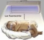 ¿Cómo se evalúa a un bebé con ictericia?