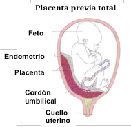 placenta1