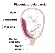placenta2