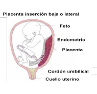 placenta4