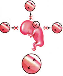 Para medirlo, buscará que el bebé se coloque de costado de manera que pueda verse un corte longitudinal