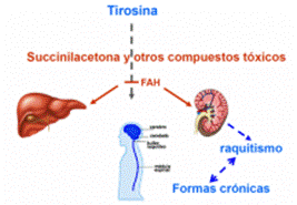 Muchos niños con Tirosinemia Tipo I desarrollan también problemas renales del tipo del síndrome de Fanconi, un trastorno raro que se caracteriza por disfunción renal asociado a raquitismo. El síndrome de Fanconi está relacionado también con episodios de vómito, deshidratación, debilidad y fiebre.