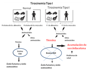 Debido a ello, se acumulan en los tejidos unos aminoácidos, como la tirosina y la metionina y unas sustancias tóxicas, como la succinilacetona y succinilacetoacetato, que a su vez inhiben el metabolismo de las porfirinas