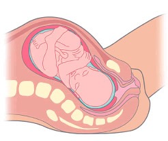 Labor o Trabajo de Parto y Parto