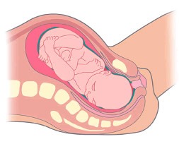 Labor o Trabajo de Parto y Parto