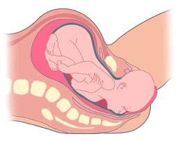 Labor o Trabajo de Parto y Parto