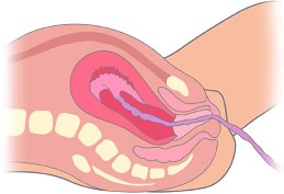 Labor o Trabajo de Parto y Parto