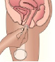 condon-7