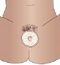 condon-9