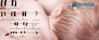 FOTO HOME_art08_340x139