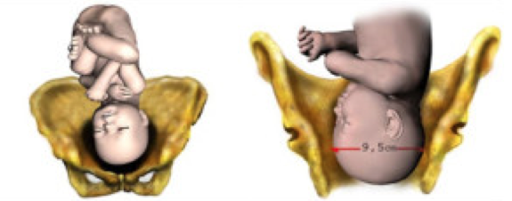 captura-de-pantalla-2016-11-04-a-las-11-33-58-a-m