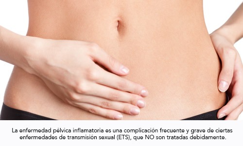 Enfermedad Pélvica Inflamatoria (EPI)