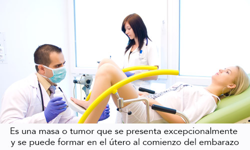 Embarazo Molar