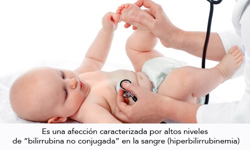 Ictericia Neonatal