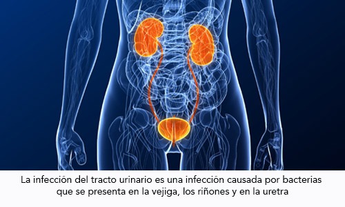 Infección Urinaria durante el Embarazo