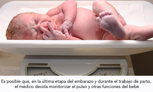 Monitorización Fetal