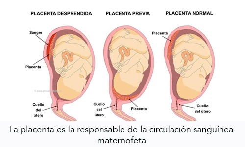 Placenta Previa