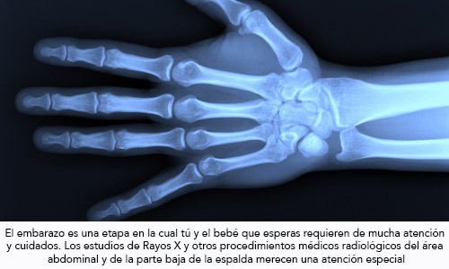 Estudios de Rayos X durante el embarazo