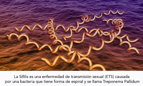Sífilis